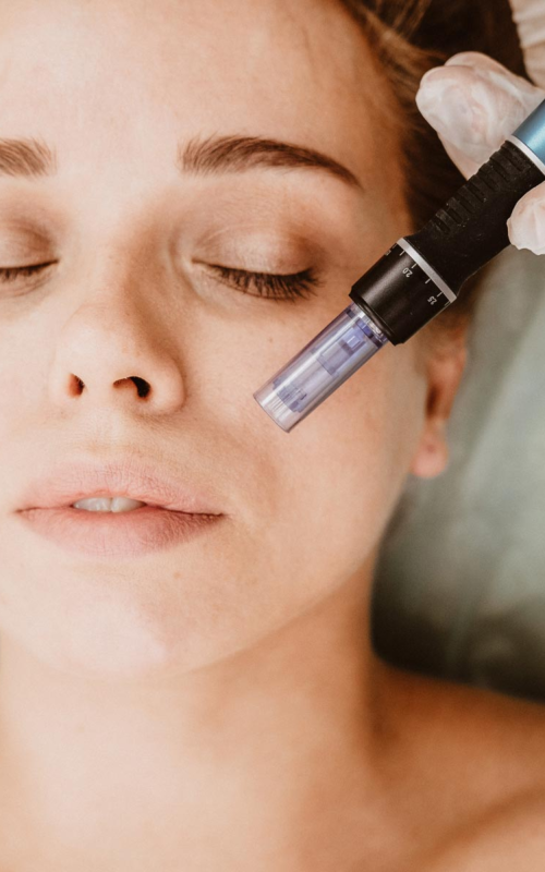 Microneedling